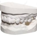 누가치과기공소 이미지