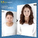 서울성형외과