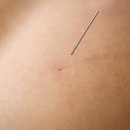 경희포레온한의원 이미지