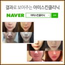 아미스킨 이미지