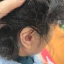 새정문의료기 | 밀양보청기 밀양서울보청기 상남면에 거주하시는 여성 고객님, 귓속형 보청기 재구매 상담입니다.