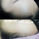 엠블리헤어
