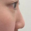 다시온의원 | 비앤영의원 코젤코 상담 예약 및 후기(내돈내산/수술예약)