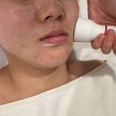 미소케어 | 송파피부관리 미소스킨케어 잠실피부관리 후기! 극락 경험한