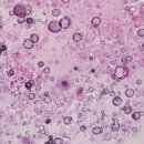 문치환한의원 | 수원 엑소좀 시술로 피부 되살리기 – 문치환한의원에서 경험하는 진짜 변화