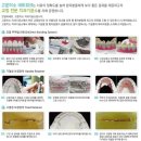 고운 치과기공소 이미지