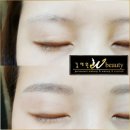 김채원W뷰티 이미지