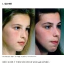 명문약국 | 비염 증상 완화 기계?, 코에픽 사용 후기 (내돈 내산) 이거 엠씨스퀘어 같은 유사과학인가요?