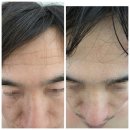 통영 피부관리 검색하다 알게 된 고성 오늘뷰티 내돈내산 후기