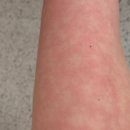 트렌디 | [경주 다이어트, 결혼준비] 누워서 살빼는 다이어트 - 케어포랩 트렌디점 솔직 후기