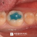 나온치과기공소 이미지