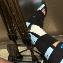 제일의료기 보조기 | 발목 전거비인대 완전파열 수술, 내돈내산 추천 아이템(1년 넘게 버티다 결국 수술함)3