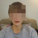 BLS(비엘에스)의원 | 강남역 입술필러 잘하는 비엘에스의원 후기