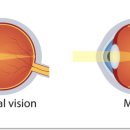 가야성모안과의원 이미지