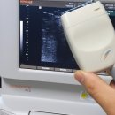 삼성종합의료기 이미지