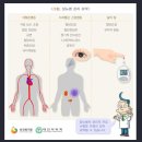 당뇨병성 말초순환장애(E11.58)[만성당뇨합병증 진단비(1년50%) 특별약관] 이미지