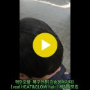 꺾인머리 복구시술 후기 입니다. 이미지