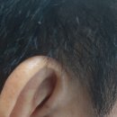 다비치히어링 보청기 등촌역점 이미지