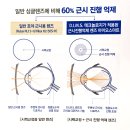 용호동063 | 고도근시 부모님이시라면, 자녀 안경은 호야 마이오스마트!