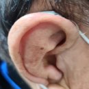 바른보청기 히어링케어 이미지