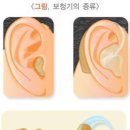 시그니아독일보청기서초센터 이미지