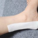 우신약국 | 다리 부종 안녕! 약국 전용 종아리 패치 '베노라이트-에프' 8시간 집중 케어 후기