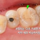 빌드업 티스토리