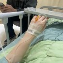 신이비인후과의원 | 타석증 자연 치유부터 수술까지 다 겪은 사람 | 제일이비인후과 타석증 수술 후기(검사, 입퇴원, 비용 등)