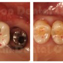 라비안치과보철과치과의원 이미지