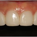 플러스치과기공소 이미지