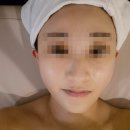 뷔에고 | 김포피부관리 뷔에고에스테틱 후기, 윤곽관리로 턱선 살아난 리얼 변화