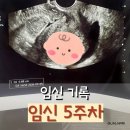 위드산부인과의원 | 임신 5주 증상 피비침 초음파 입덧