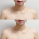 부천 에어바디 전문점 아망데에서 승모근 관리받기