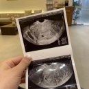 연세수피아산부인과의원 이미지