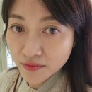 아이블룸 | 눈밑꺼짐 부작용 없던 블룸쥬베룩 아이 후기