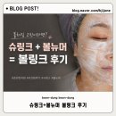 모아한의원 | 춘천한의원 볼뉴머 &amp; 슈링크 리프팅 솔직 통증, 볼 처짐 개선 효과 후기