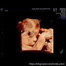 노블산부인과의원 이미지