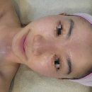 [결혼기록]#11 신부관리는 어떻게?(홍대, 연남동 김에스테틱 후기 / 화이트태닝 / 백옥주사)