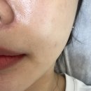 [오산] 깐달걀 피부 스킨플래닝 솔직후기 &#34;오산 무모한왁싱&#34;