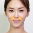 리샘한의원 대구점 이미지