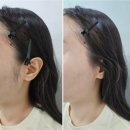 다사랑피부샵 | 일산 마두역 눈썹 왁싱, 구레나룻 왁싱 잘하는 곳! <더브로우샵>