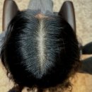 해사람 | 중랑두피문신 해본 사람 후기 ㅣ 만족한 이유 vs 후회하는 이유 현실 비교