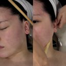 동산라인아파트 | 익산피부관리 에르벨에스테틱 솔직 후기 | 익산미용학원 테크닉으로 얼굴라인 정리