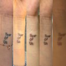 아우름의원 | 타투 제거 3회차 후기(강남아우름의원)