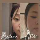 hong 에스테틱 | 주안에스테틱 윤곽관리 찐후기, 미스킨에스테틱에서 웨딩관리 시작 육아맘추천