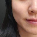 용문힐링닥터 | 용문동 피부관리 '설브 꼼에스테틱 용문점' 대전 최초 도입 합법레이저 닥터밸루 후기