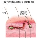 세종 옴진드기퇴치, 조치원 옴진드기방역 2차 집중 특수방역소독 후기 | 미소창방역