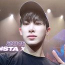 my precious baby with his swollen face 이미지