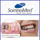 티피치과기공소 이미지