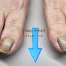 리솜사랑의원 네이버블로그